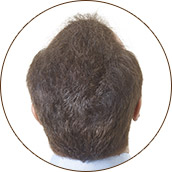 Light brown of after02