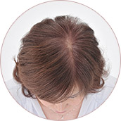 Light brown of before01