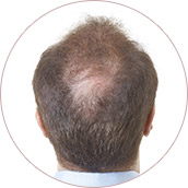 Light brown of before02
