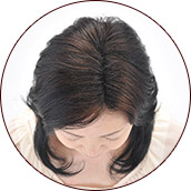 Dark brown of after01