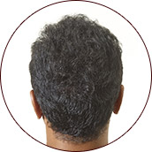 Dark brown of after02
