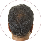 Dark brown of before02